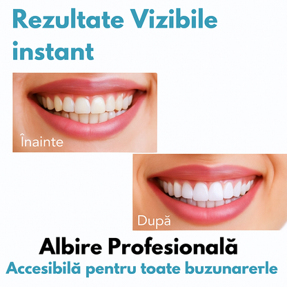 Pastă pentru Albirea Dinților V34 - HeySmile™